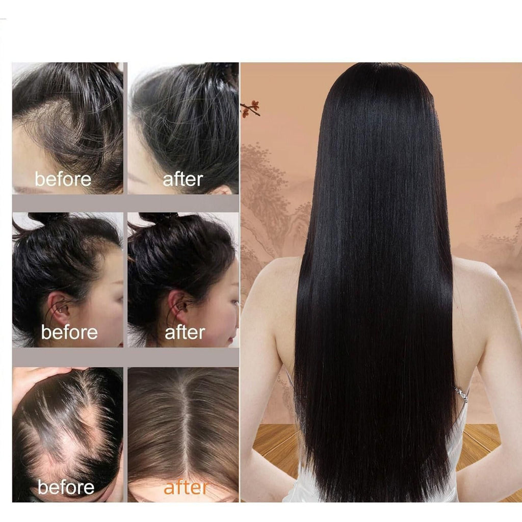 Anti-Hair Loss Shampoo