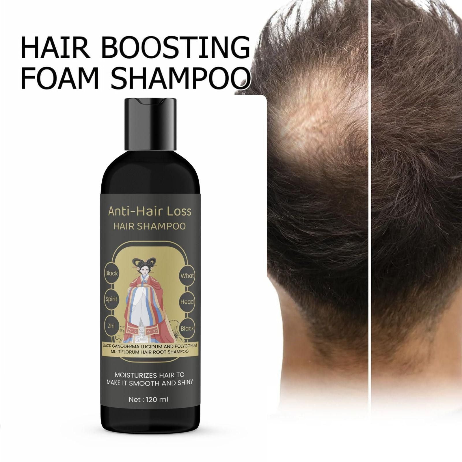 Anti-Hair Loss Shampoo