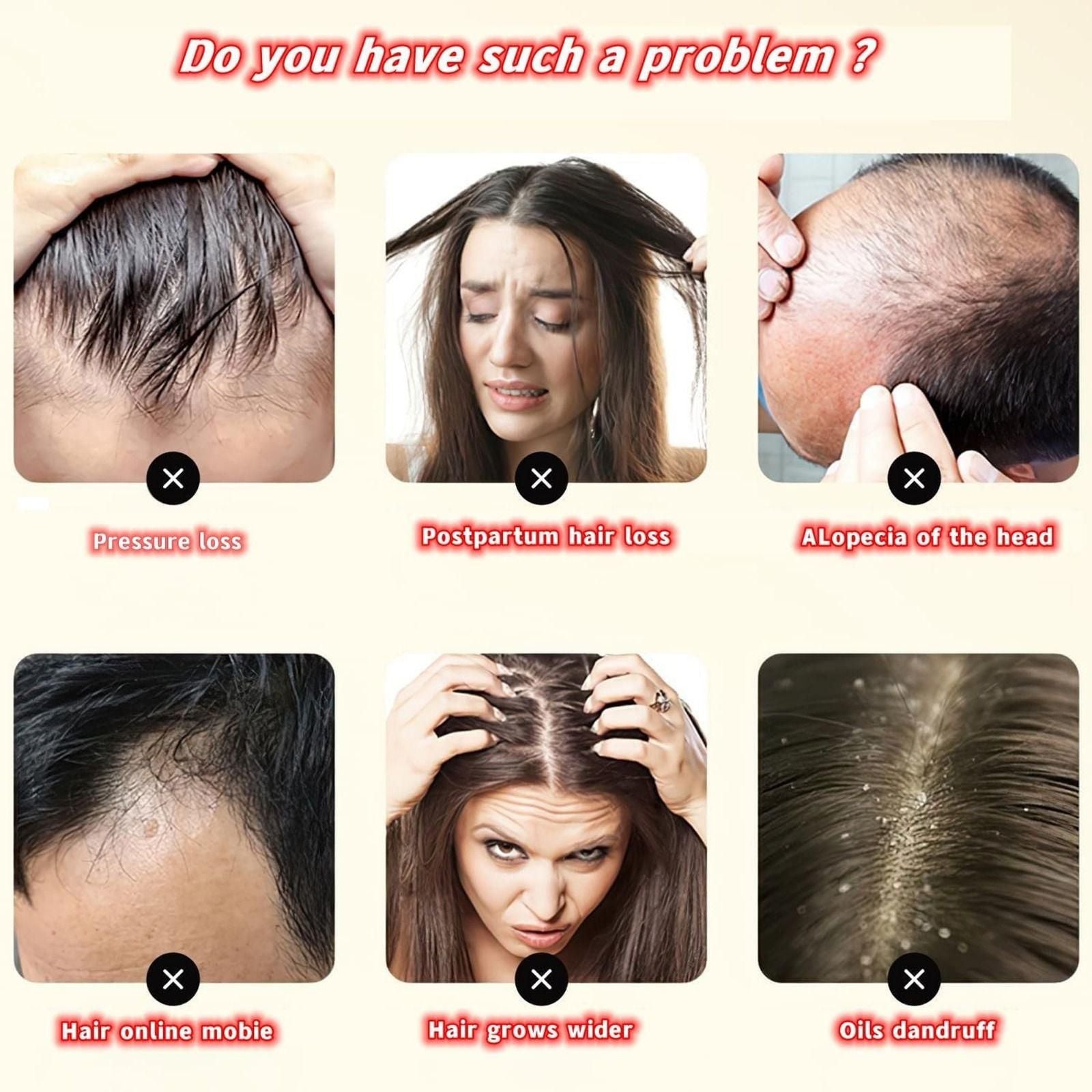 Anti-Hair Loss Shampoo